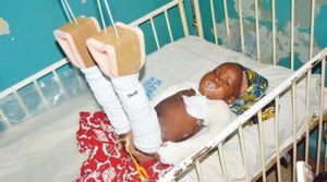 21-month old Musa Murtala on his hospital bed